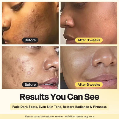 Gleamin Superactive Serum - Image 4