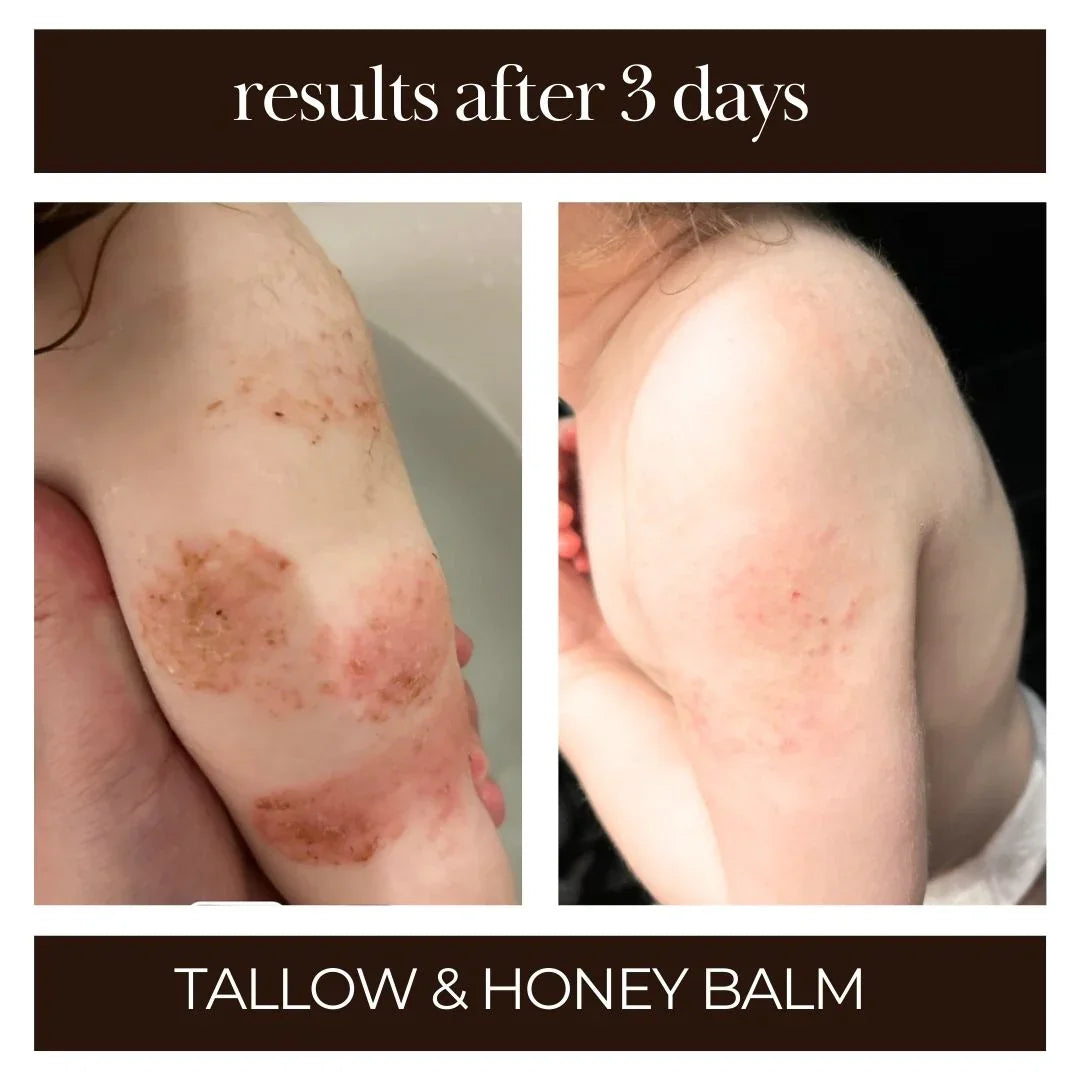 Tallow Me Pretty Tallow and Honey Balm - 3pk
