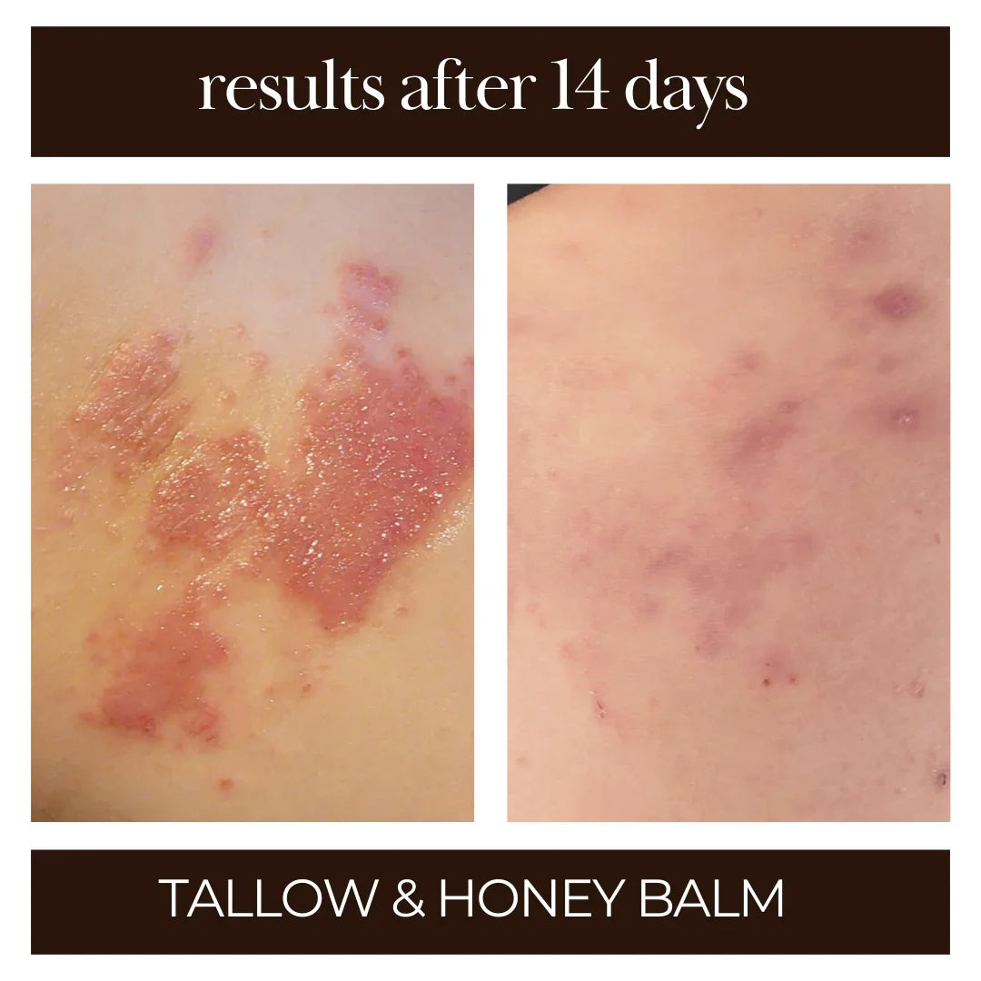 Tallow Me Pretty Tallow & Honey Balm