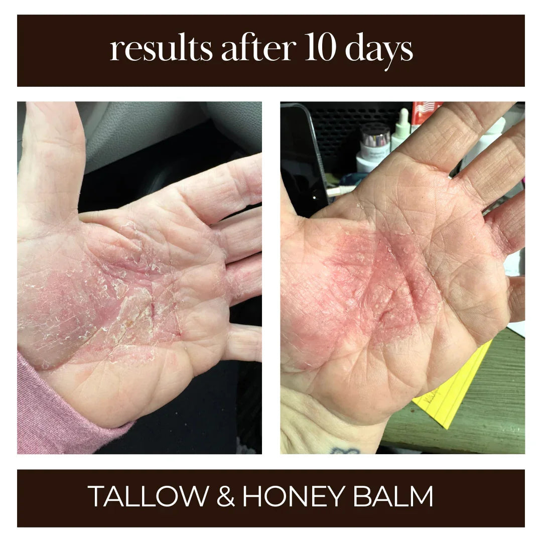 Tallow Me Pretty Tallow & Honey Balm