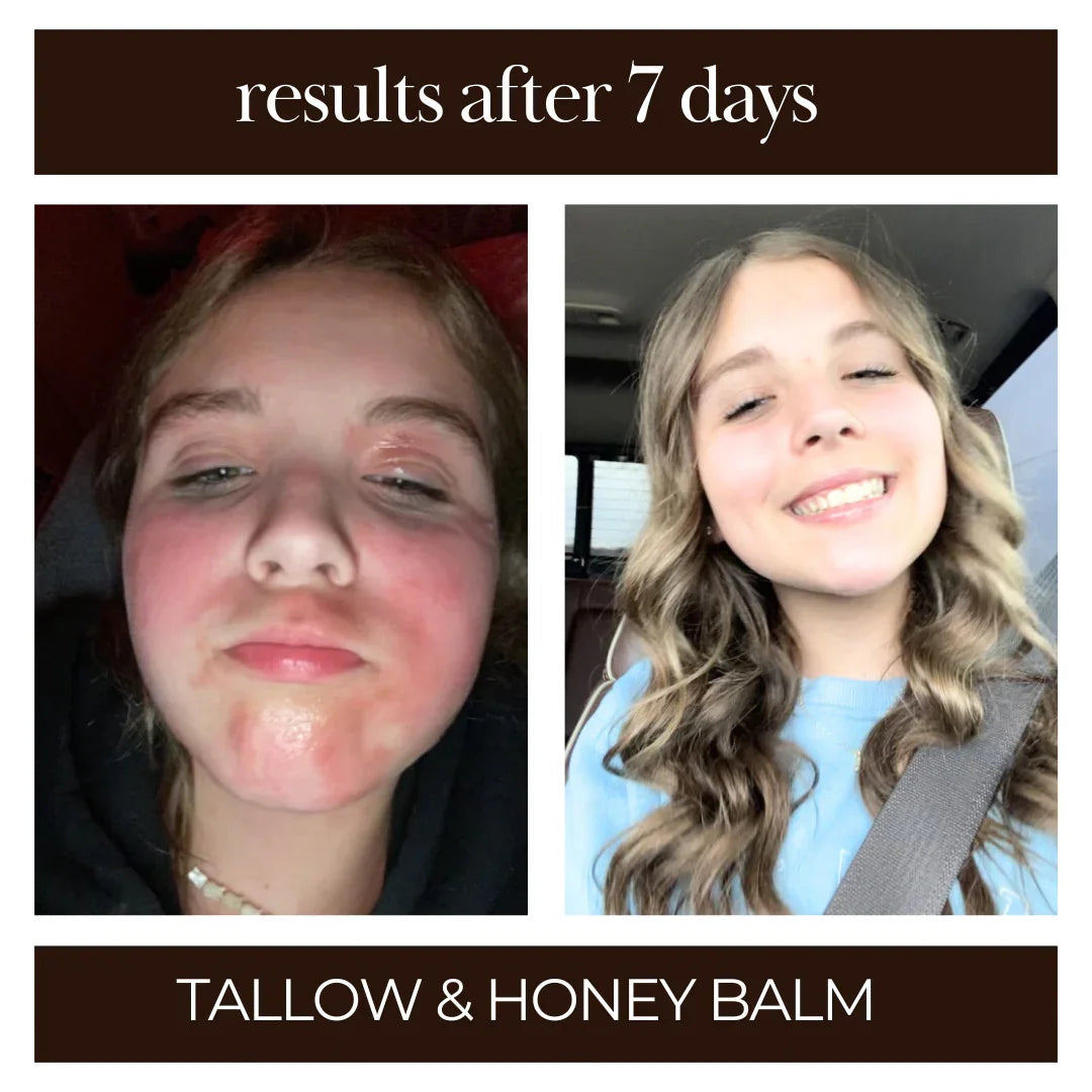 Tallow Me Pretty Tallow and Honey Balm - 3pk