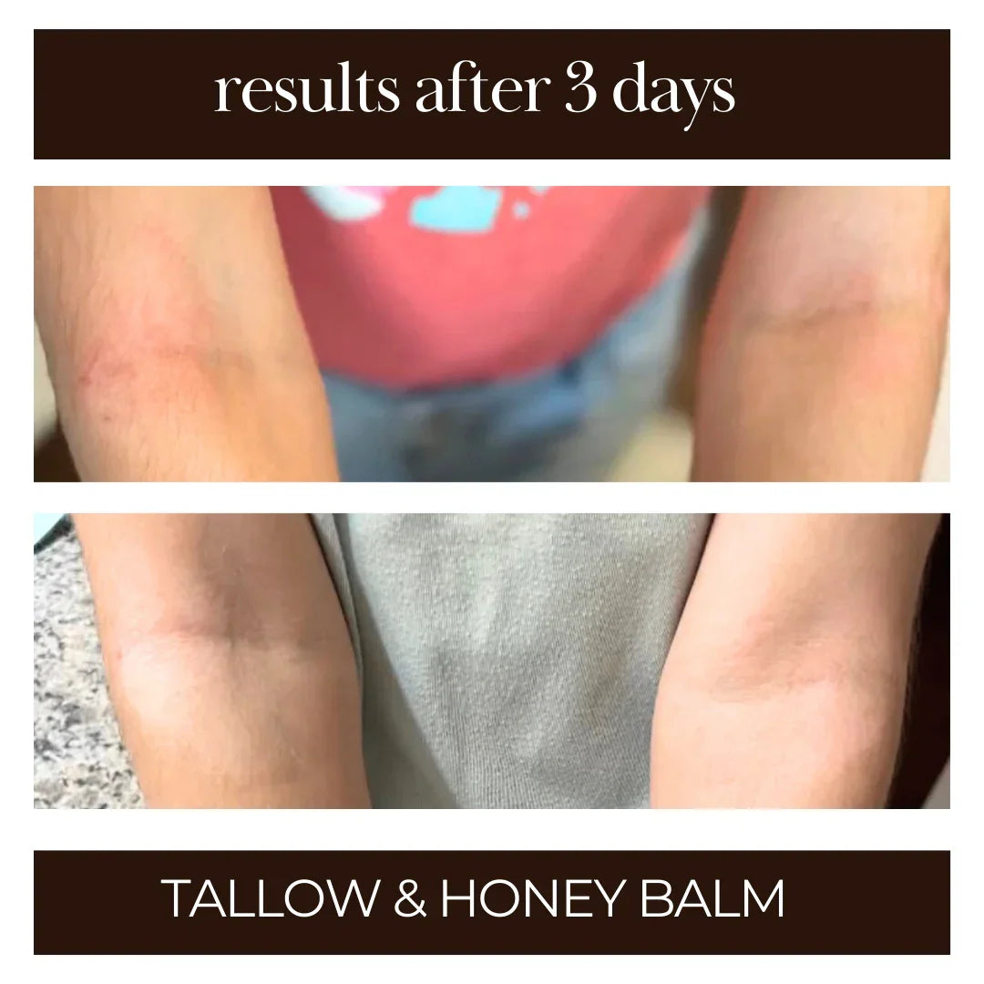 Tallow Me Pretty Tallow & Honey Balm