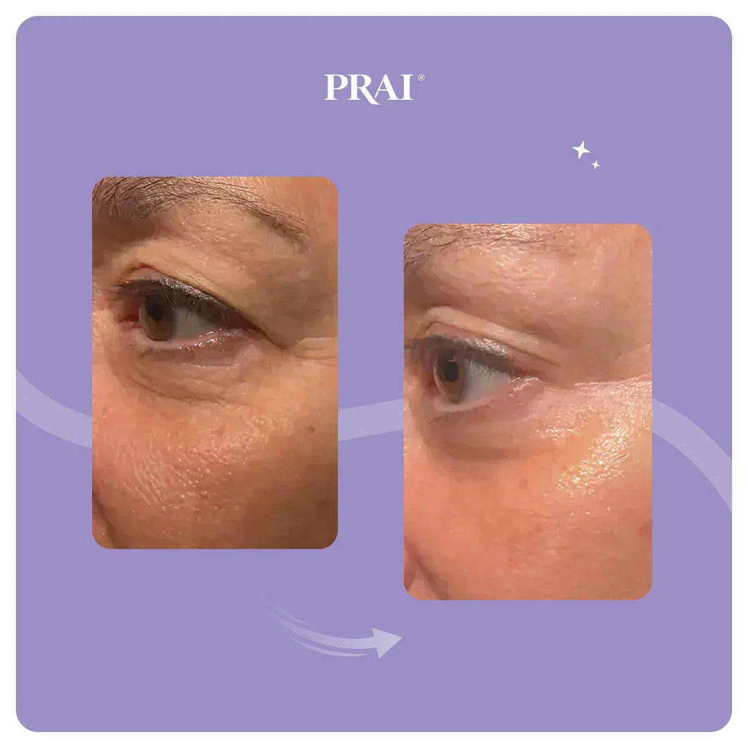 PRAI Beauty Ageless Eye Tight Uplift Serum