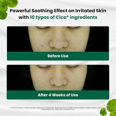 Gowoonsesang Cosmetics., Co. Ltd. - インターナショナルコスメティック ス Red Blemish Clear Soothing Korean Moisturizer Face Cream - Image 3