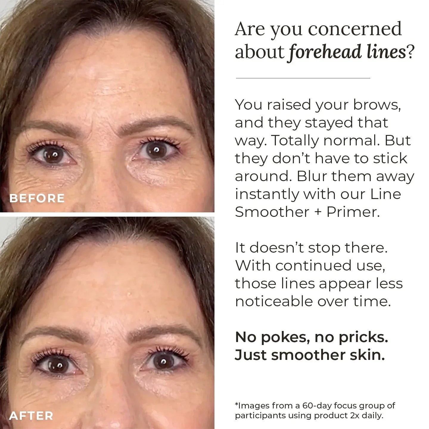 AmazingCosmetics Line Smoother + Primer with Neodermyl®