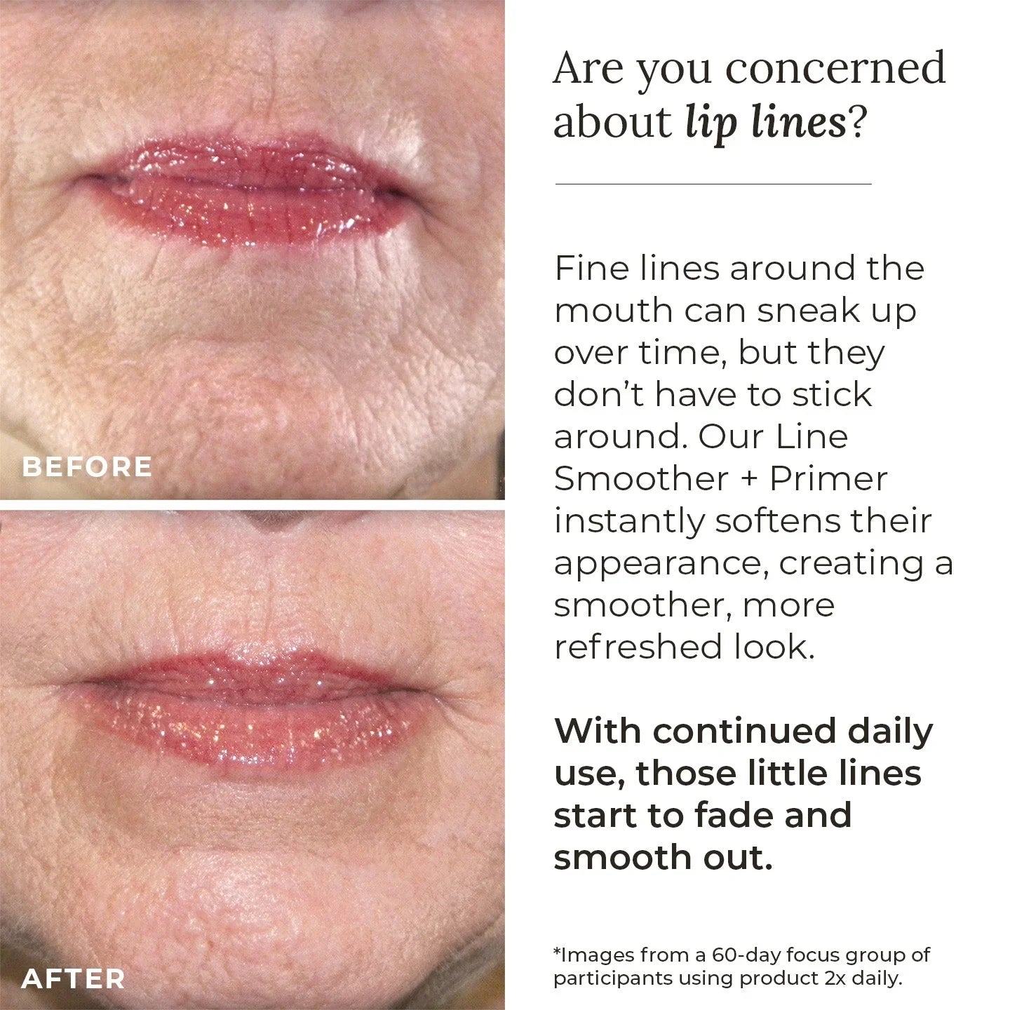 AmazingCosmetics Line Smoother + Primer with Neodermyl®