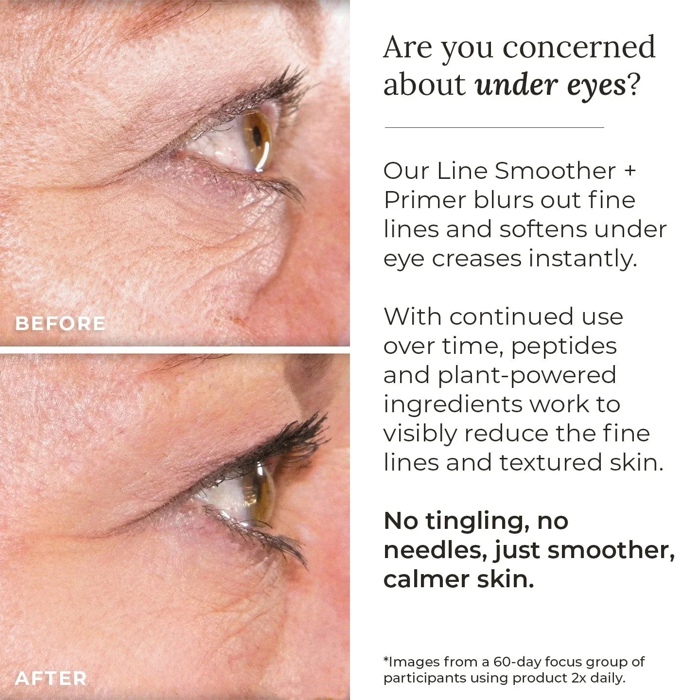 AmazingCosmetics Line Smoother + Primer with Neodermyl®