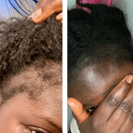 Ethnic Gals Hair Oil Mega Ayurvedic Growth