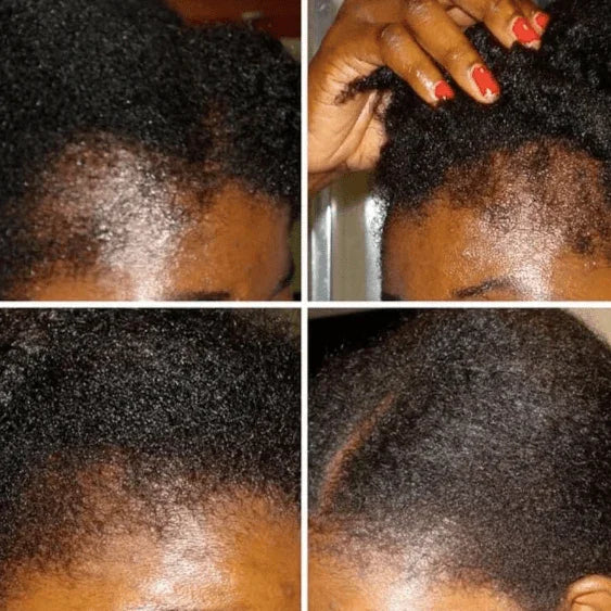 Ethnic Gals Hair Oil Mega Ayurvedic Growth