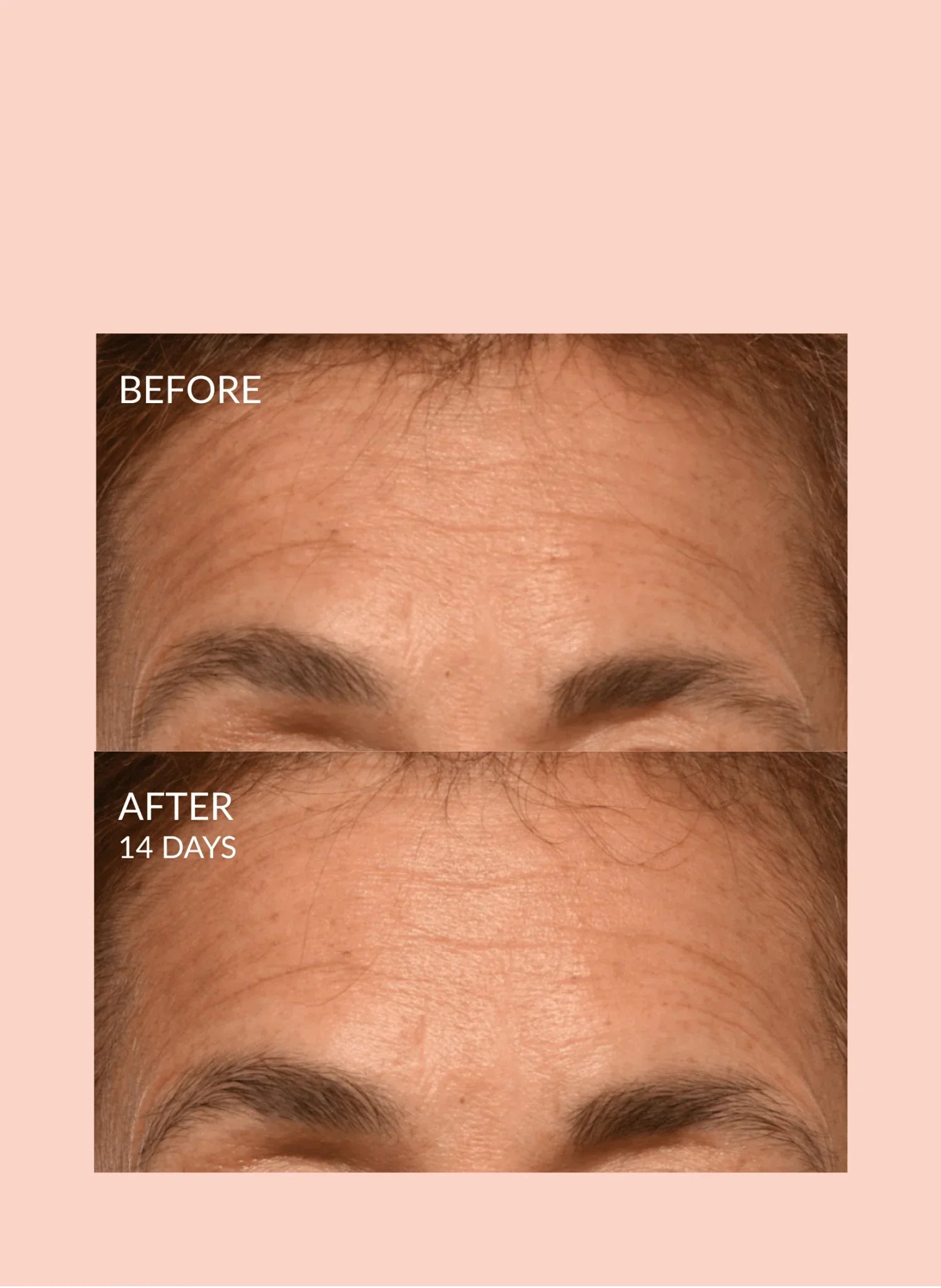 Caire Beauty Triple Lift Molecule Mask